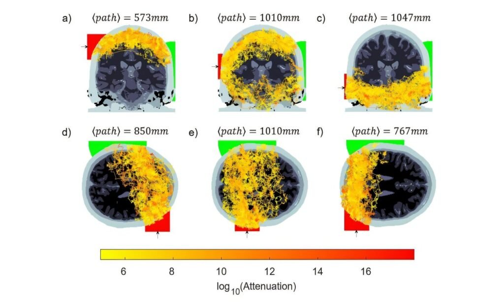 cerebro humano emite luz cuando piensa - junio 2025
